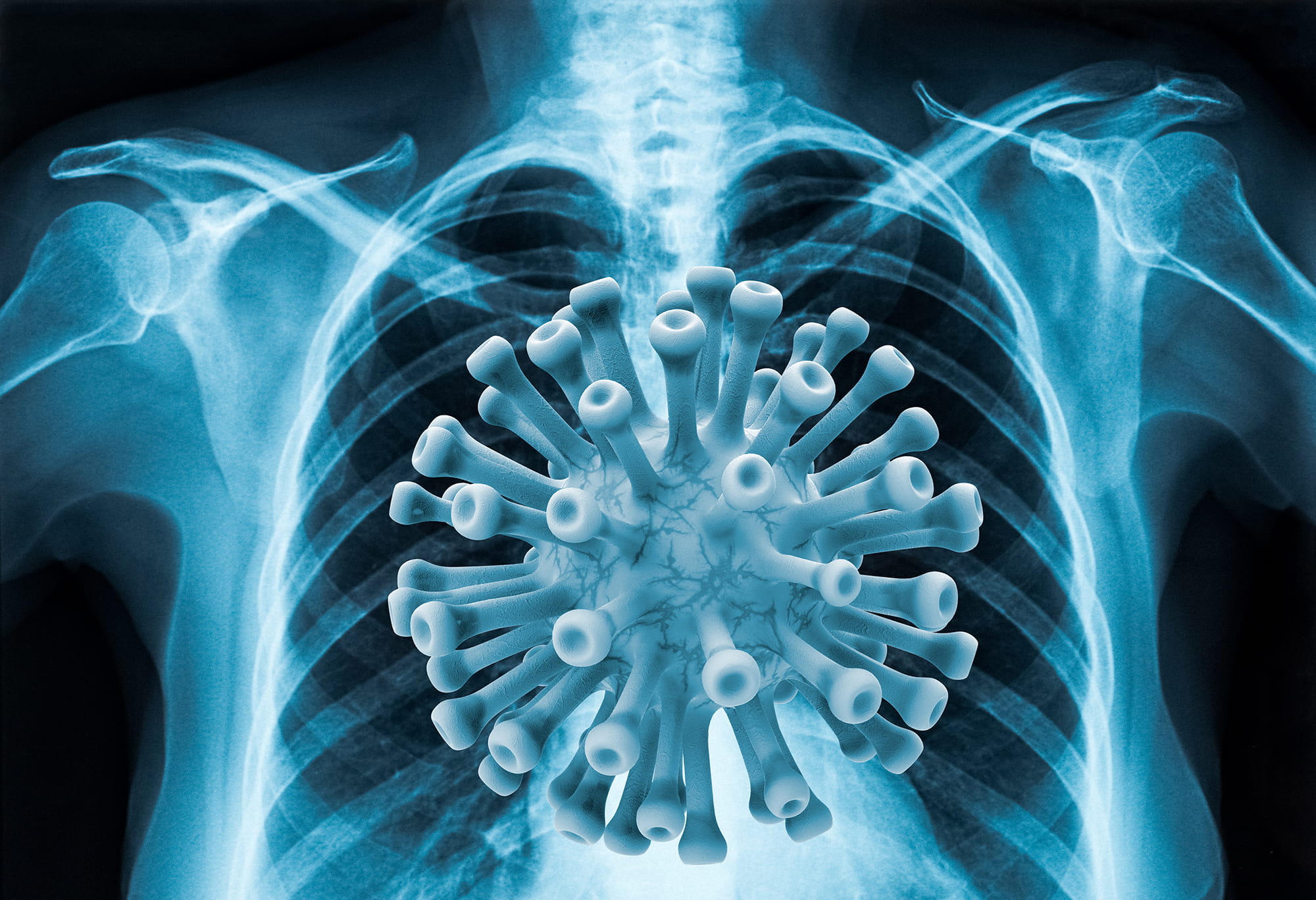 lungs covid19